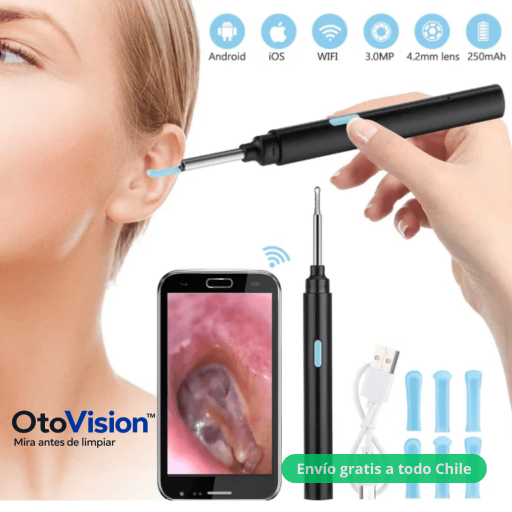 Observa tu oído en pantalla antes de limpiar: Otoscopio con cámara OtoVision™ - 2da unidad 50% OFF