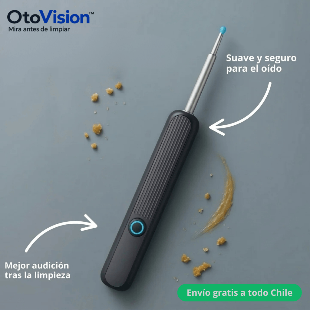 Observa tu oído en pantalla antes de limpiar: Otoscopio con cámara OtoVision™ - 2da unidad 50% OFF